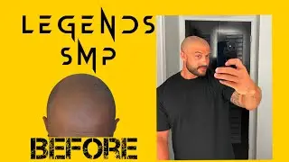 How scalp micropigmentation ( SMP ) changed my life