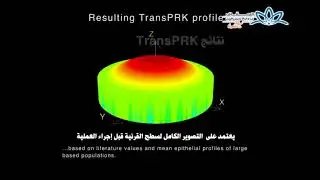جهاز Schwind Amaris  لتصحيح عيوب الابصار باستخدام تقنية TransPRK