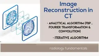 CT Image Reconstruction | CT RECONSTRUCTION, FBP, ITRATIVE RECONCTRUCTION | radiology fundamentals