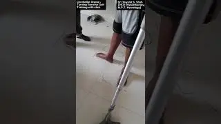 Cerebellar Ataxia:- Part:- 38:- EXCLUSIVE INDEPENDENT TURNING BALANCE DYNAMIC EXERCISE WITH STICK