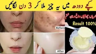 Best Facial Wrinkles Glow Skin Remove Pigmentation Rao Milk Such a fair skin care