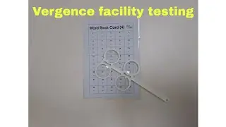 Vergence facility test explained