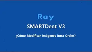 SMARTDent V3: &iquest;C&oacute;mo Modificar Im&aacute;genes Intra Orales?