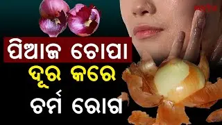 Onion Peel Benefits: A Natural Remedy for Skin Diseases