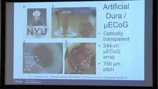 Jonathan Viventi (Duke University) - Flexible electronics for neural interfaces