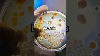 Ames Test:  Harnessing the DNA Repair Response to Detect Carcinogens.