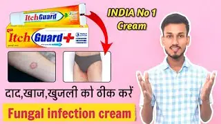Itch guard | Itch guard cream uses in hindi | Fungal infection cream | दाद खाज खुजली की दवा