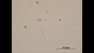 Excystation of Chromera velia zoosporangium (accelerated 2x)