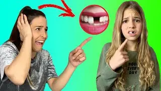 SE ME CAE UN DIENTE Y NO PUEDO IR AL DENTISTA - GRABADO TODO CON CÁMARA OCULTA