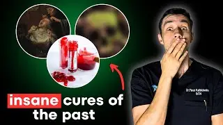 BLOOD, SKULLS & MADNESS: history&rsquo;s most SHOCKING brain &ldquo;cures&rdquo;