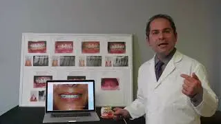 Dental Bone Grafting - Lanap