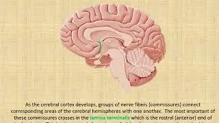 cerebral commissures meaning