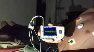 ECG Breathplay