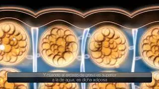 Esthederm: la celulitis