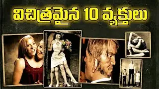 Top 10 Amazing People In The World | Born With Abnormality | RAR Facts