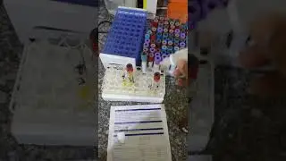 طريقه عمل تحليل الصفراء الكلىtotal bilirubin فى المعمل بالتفصيل