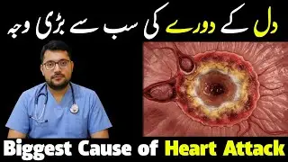 This One Habit Is Causing Most Heart Attacks – Stop Now! 