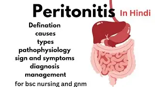 peritonitis
