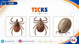 44. Ticks / PSM Simple for NEET PG and FMGE