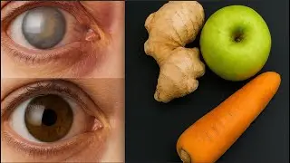 ✅NATURAL BOMB💣for Eye Health👁️ &mdash; 🫚Ginger + 🥕Carrot + 🍏Apple | Natural Nutrition Health
