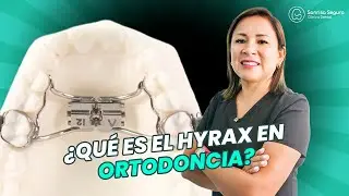 ↔️ Hyrax Dental: Creando el Espacio para una Sonrisa Perfecta 🦷