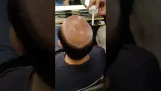 How To Apply a Silk Base Patch Like a Boss #shorts #youtubeshorts