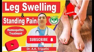 Leg Swelling & Standing Pain | Breast Injury Homeopathic Treatment / Bellis Per Q #homeopathy