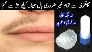 Fitkari for Unwanted Facial Hair removal permenantly | Ghair Zaroori Balon se Nijat Hamesha Ke Liye