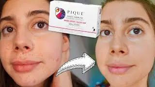 I TESTED 2 WEEKS OF VITAMIN C SUPPLEMENTS FOR CLEAR SKIN || Does Pique Tea Work!?!?