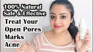 चेहरे के रोमछिद्र, दाग धब्बे और निशान, एक्ने ka solution | Nature Sure Pores & Marks Oil