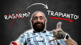 Trapianto Capelli Turchia: La mia esperienza da VIP! 🌟 Hotel 5 Stelle | Testimonianza reale