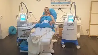WEG MET JE BUIKJE DOOR BEVRIEZEN | BEAUTY OVER 40 | COOLSCULPTING