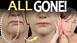 🔥Lift Cheeks Quickly and Remove Smile Lines (nasolabial fold). 🔥 Fastest Way for Results! 🤩