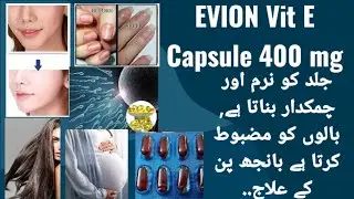 Evion Tablet Uses In Urdu | 400 mg | Uses, Side Effects & Dosage