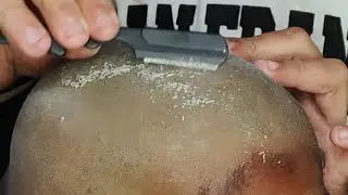 Hard dandruff clean head shave ASMR relaxing sound tutorial zaibi Barber shop 2025