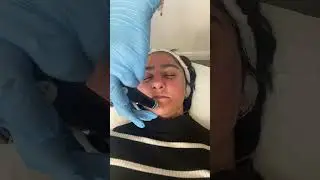 Getting my first ever Hydra-facial with Este Medical ❤️ #hydrafacial #skincarejourney