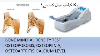 BONE MINERAL DENSITY TEST METHOD