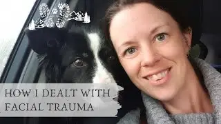 Dealing with Facial Trauma and Putting My Face On YouTube