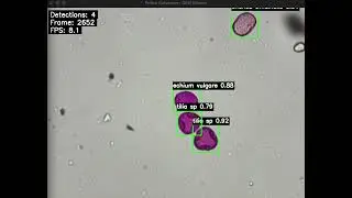 Pollen Detection with OpenFlexure Microscope and YOLO11n | AI-Powered Microscopy Sneak Preview