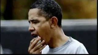 Obama gets 12 stitches after basketball injury