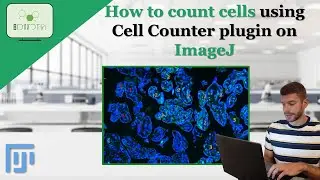 How to count cells using the Cell Counter Plugin on ImageJ #cell #count #plugin #imagej #science