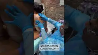 FOLLOW HER SEROMA JOURNEY