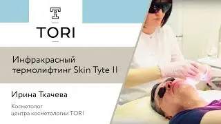 Ирина Ткачева. Инфракрасный термолифтинг Skin Tyte II