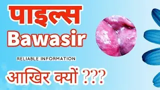 aakhir kyun PILES ? kya karan se hota hai - BAWASIR ( REASONS ) kyun hota hai ?