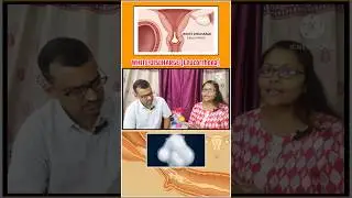 सफेद पानी ( white discharge) /leucorrhea ka  इलाज क्या हैं ?#shortsfeed #youtubeshorts