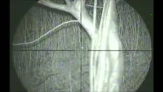 Rabbit control with a .17hmr and NS200