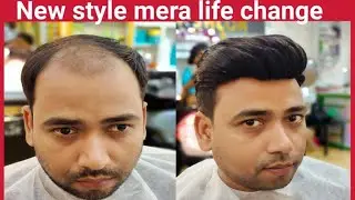best hair Patch center in Kolkata .9836918298 hair wig expert.clipping system hair patch for men