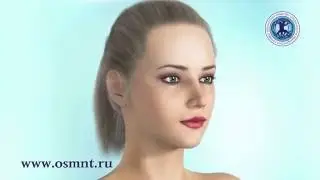 ОСМНТ OSMNT Схема установки нитей Silhouette 12 конфигурация 