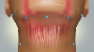 accutite animation 1