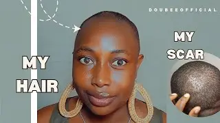 Why I cut my Hair | My Scar story (little) | Healing 